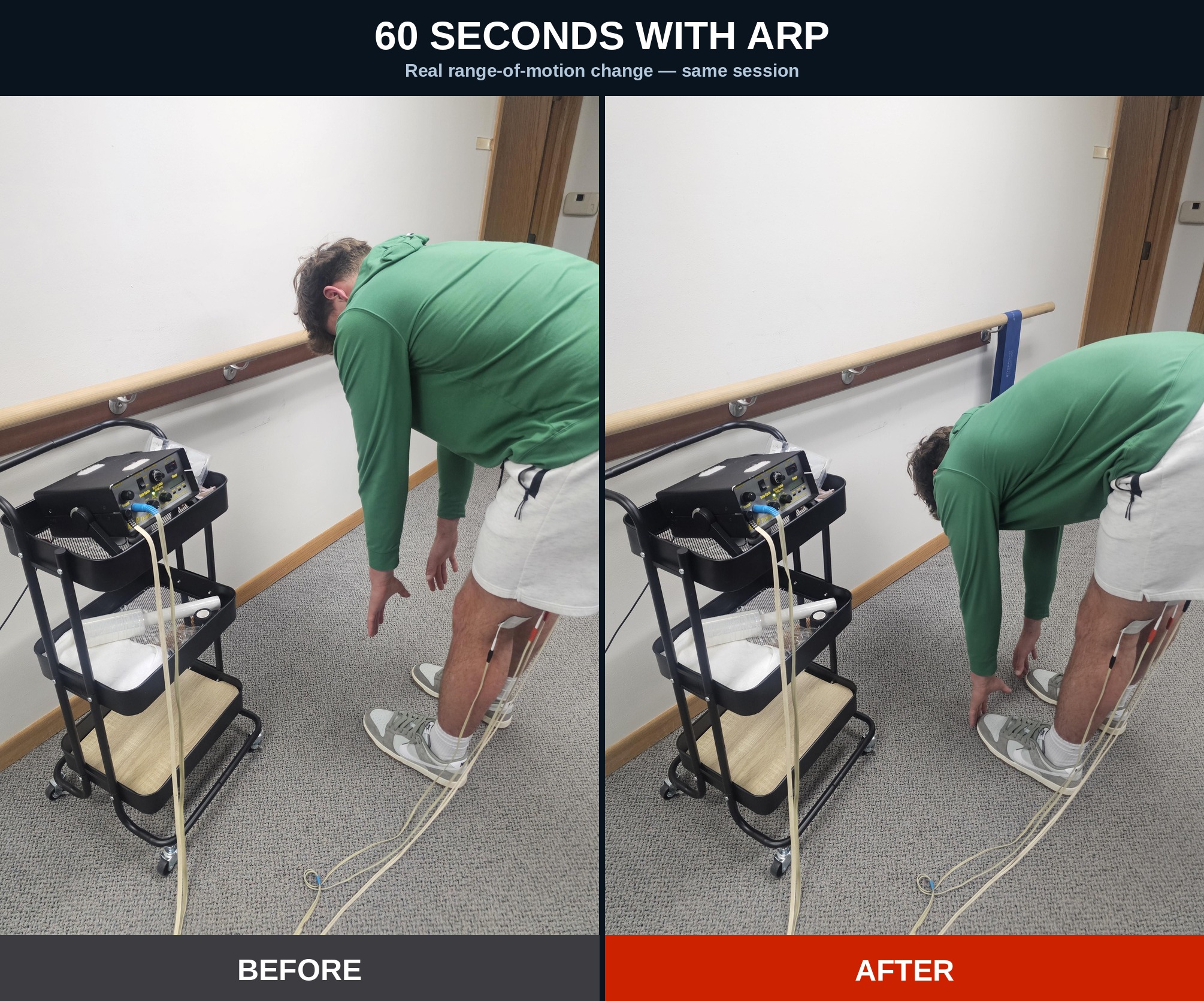 ARP Wave before and after range of motion